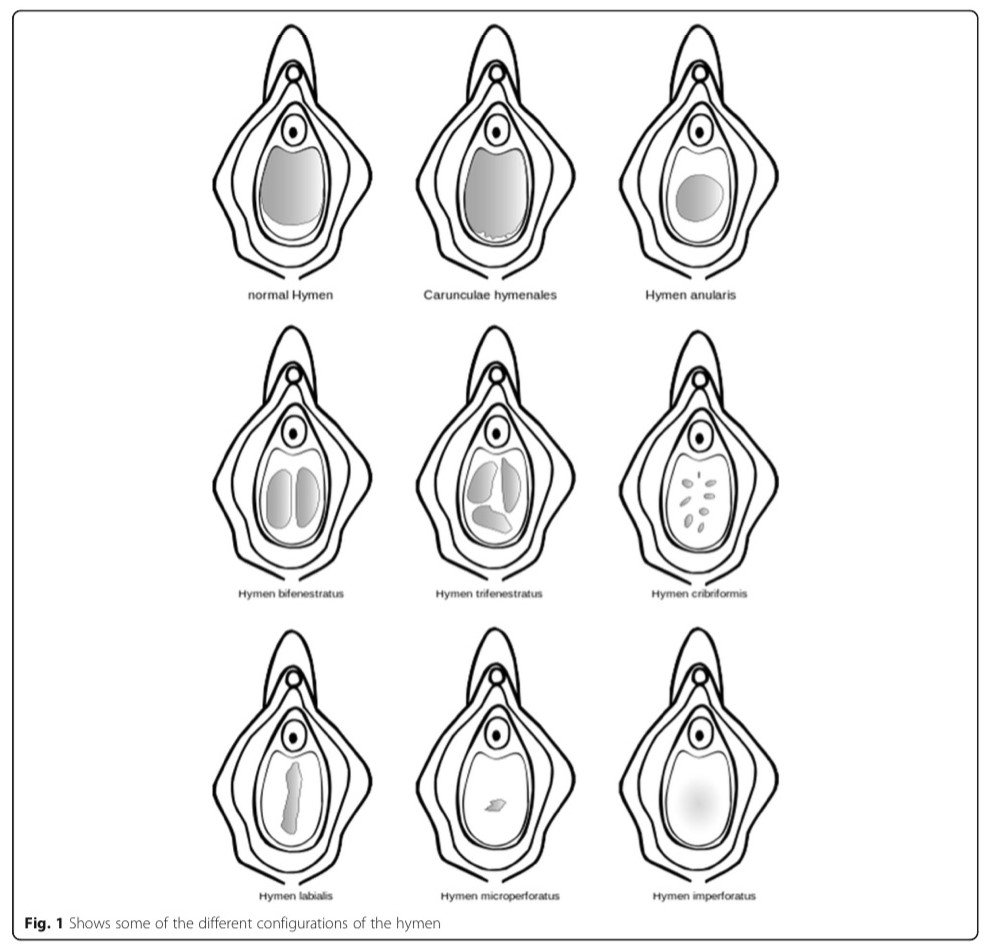 virgin-marys